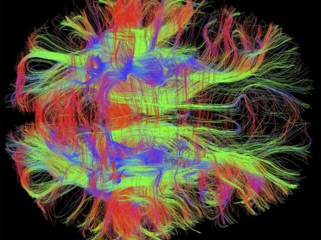 Schéma des circuits neuronaux illustrant la complexité des connexions cérébrales et leur sollicitation lors de la gestion de la charge mentale
